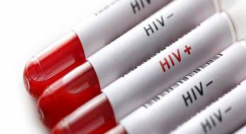 برای تشخیص HIV چه آزمایشاتی میتوان انجام داد؟