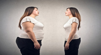 انواع روش های کاهش وزن و درمان چاقی