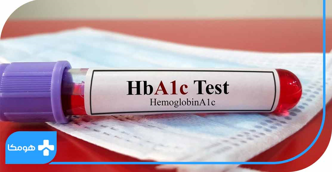 تشخیص دیابت با انجام آزمایش HbA1C
