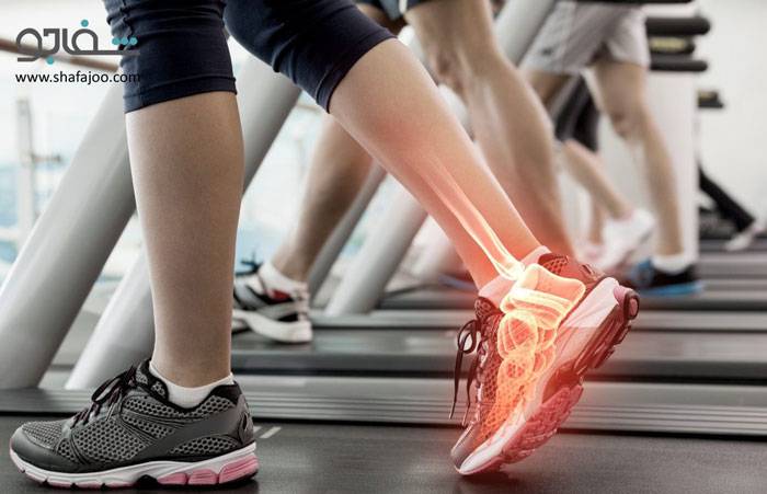 پیچ‌خوردگی‌ و کشیدگی عضلات و مفاصل - sprains and strains