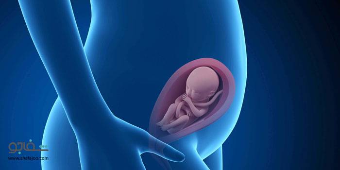 بیرون‌زدگی‌ رحم‌ - uterine prolapse