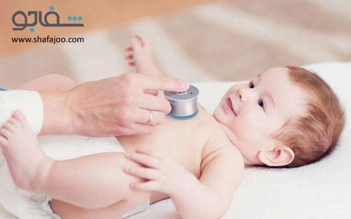 تنگی مادرزادی پیلور (تنگی هیپرتروفیک پیلور) - pyloric stenosis congenital