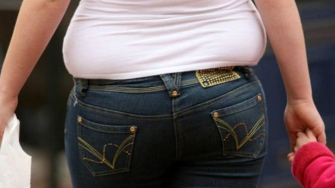 چاقی مفرط، علائم و عوامل بروز آن