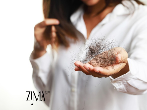 درمان ریزش مو با ۳ روغن گیاهی ساده