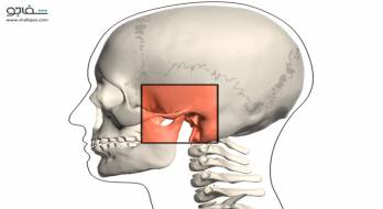 نشانگان‌ مفصل‌ گیجگاهی‌ ـ فک‌تحتانی - temporomandibular joint(tmj)syndrome‌