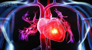 بیماری‌ دریچه‌ای‌ قلب‌ - Heart valve disease