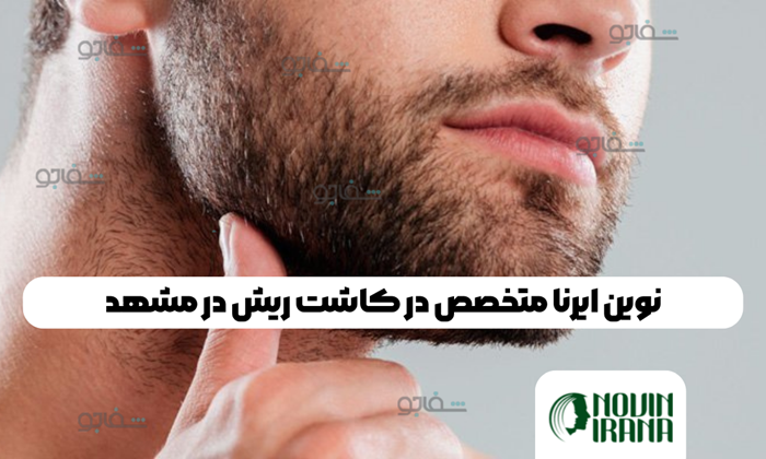 کاشت ریش در مشهد با جدیدترین تکنیکها در کلینیک نوین ایرانا